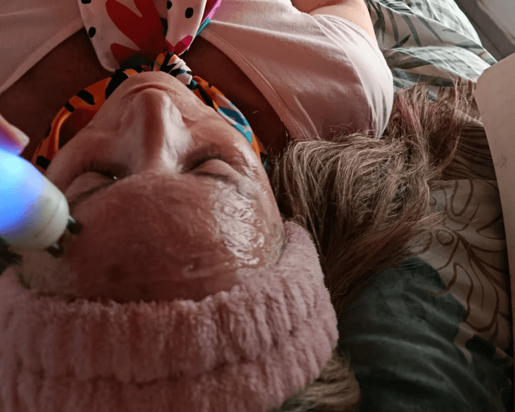 Tratamiento Lifting (radiofrecuencia/mesoterapia)