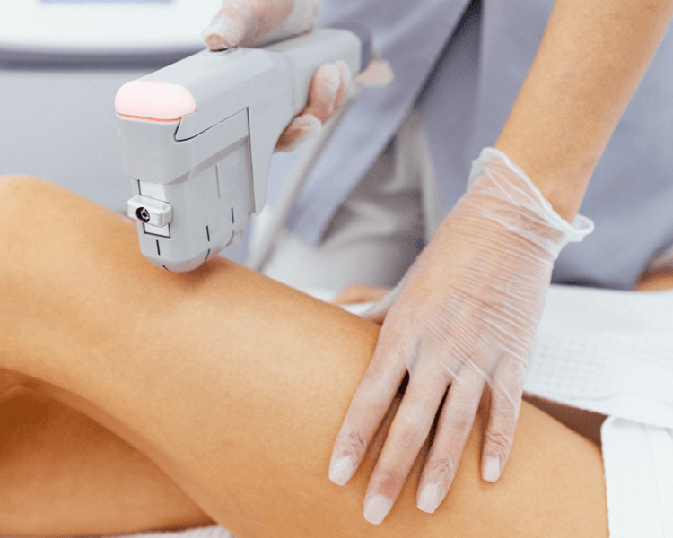 HIFU CORPORAL 1 zona (3 sesiones)