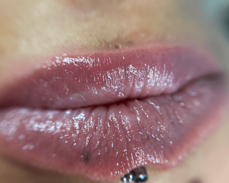 Hidra lips solo una sesión