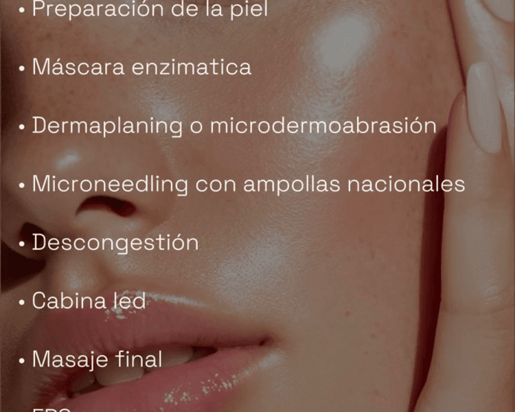 Microneedling con ampollas nacionales