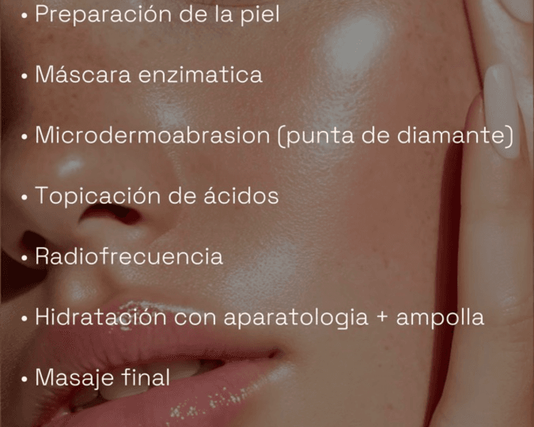 Limpieza facial SHINE con electroporacion y radiofrecuencia (Marcela)