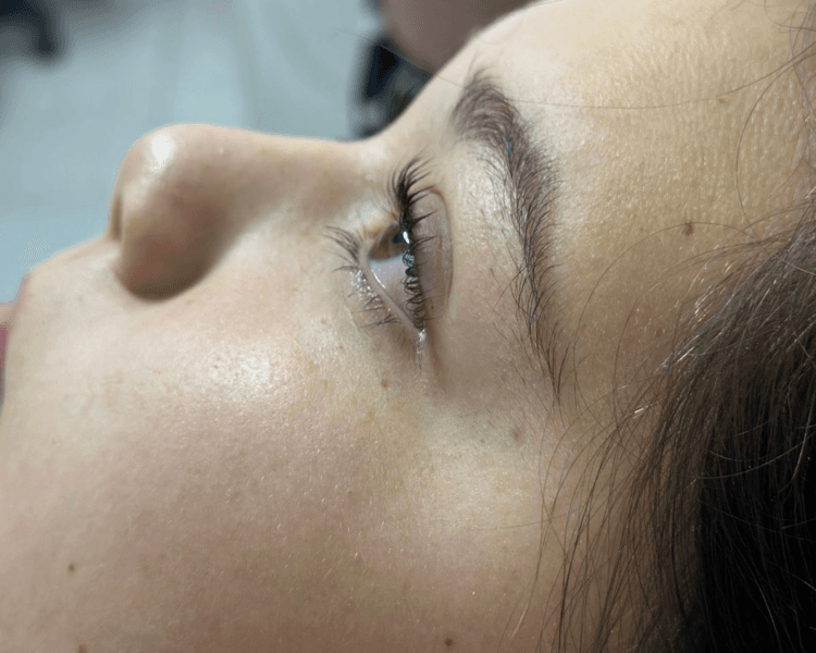 Lisfting de pestaña