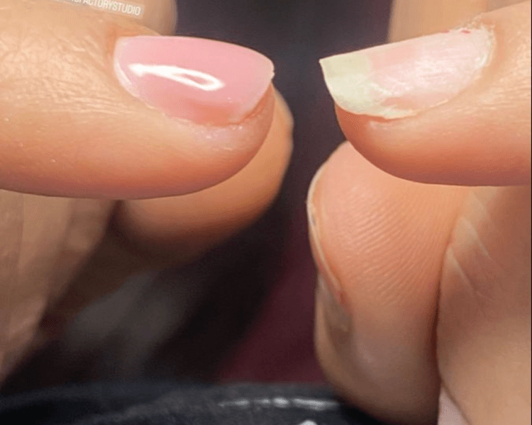 Rubber sobre uña natural