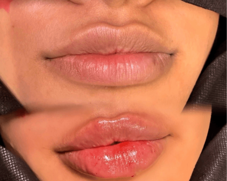 Natural Lips
