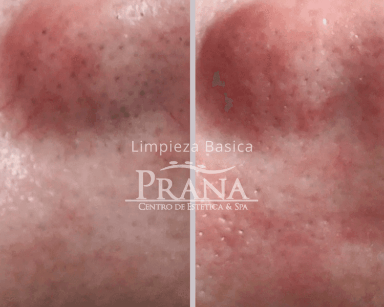1- ✨ Glow Up Limpieza Profunda Oxigenante