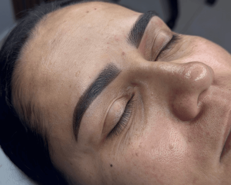 NEUTRALIZACION DE CEJAS