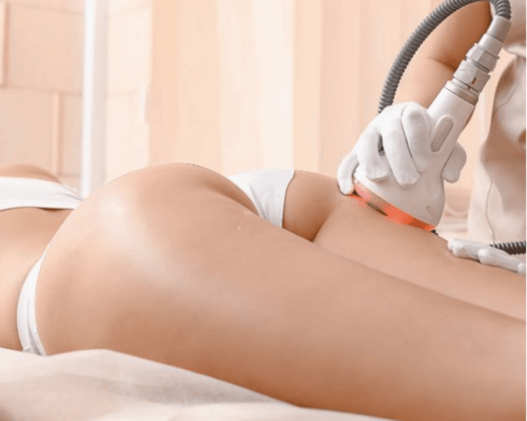 Levantamiento de gluteos