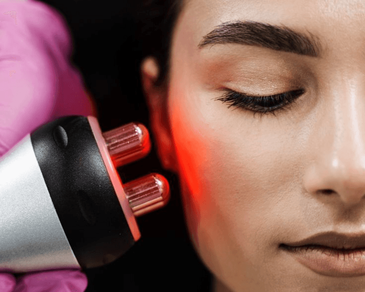 Higiene facial profunda + Radiofrecuencia