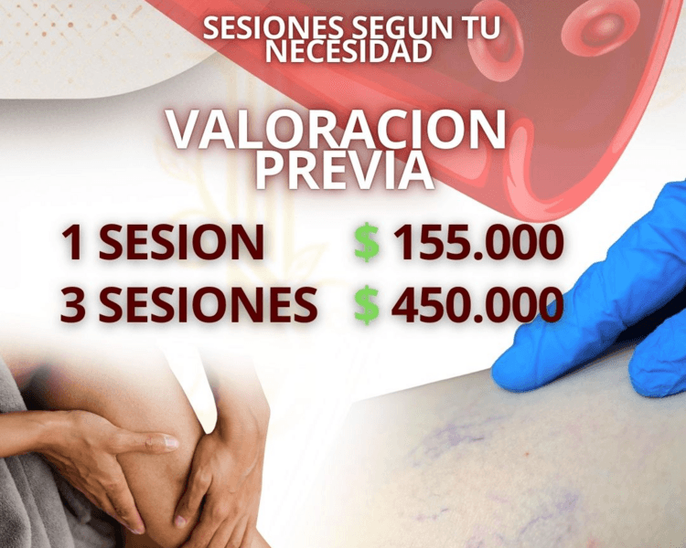 1 SESION ESCLEROTERAPIA