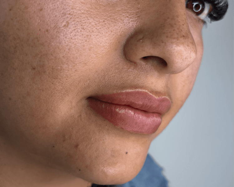 Neutralización de Labios