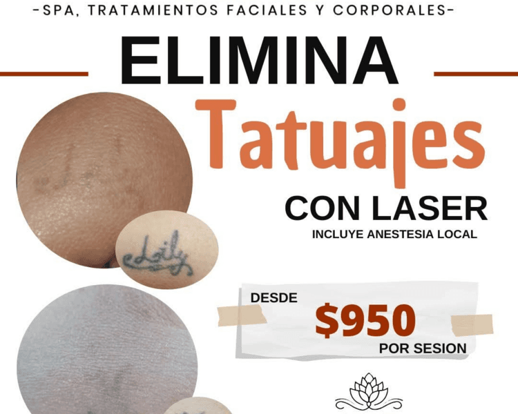Tatuajes de 0 a 10 cm