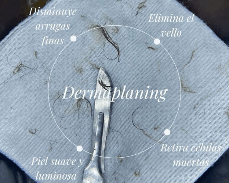 Dermaplaning 💫