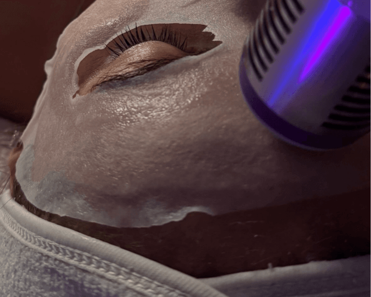 COLLAGEN BOOST PRO — Microneedling