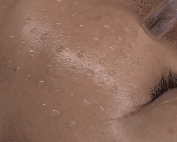 RADIANCE SKIN — Limpieza + Peeling