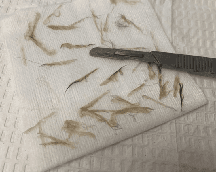 TOTAL SKIN RENEWAL — Limpieza + Dermaplaning + Peeling