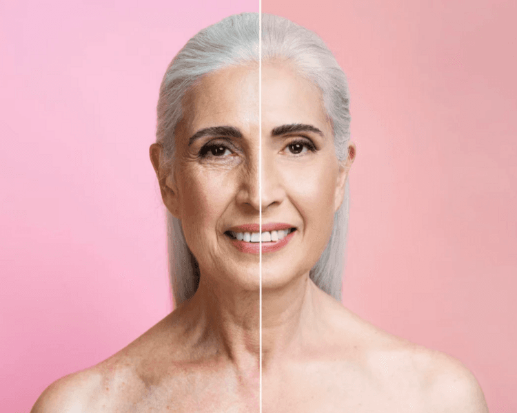 Bioestimulador Fulloria ✨