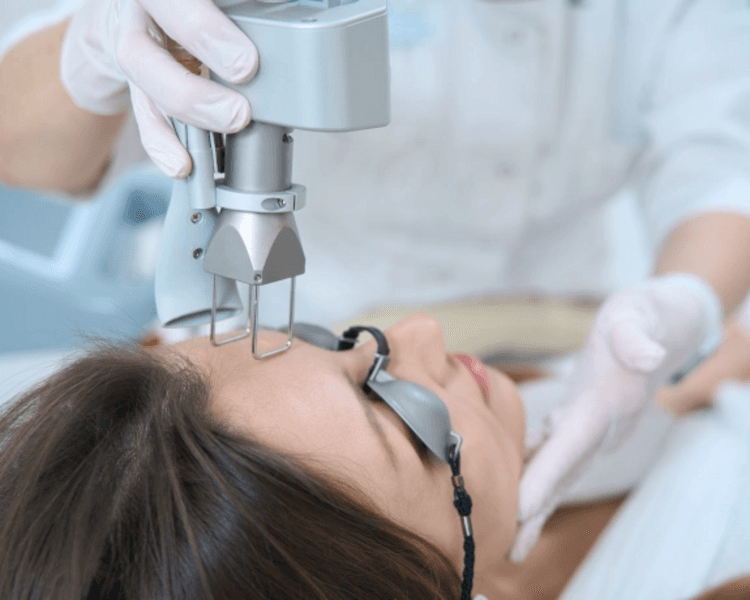 Laser CO2 Ablativo - Zona corporal