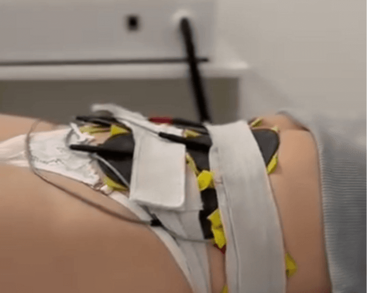 Gluteos UP + ELECTROESTIMULACIÒN