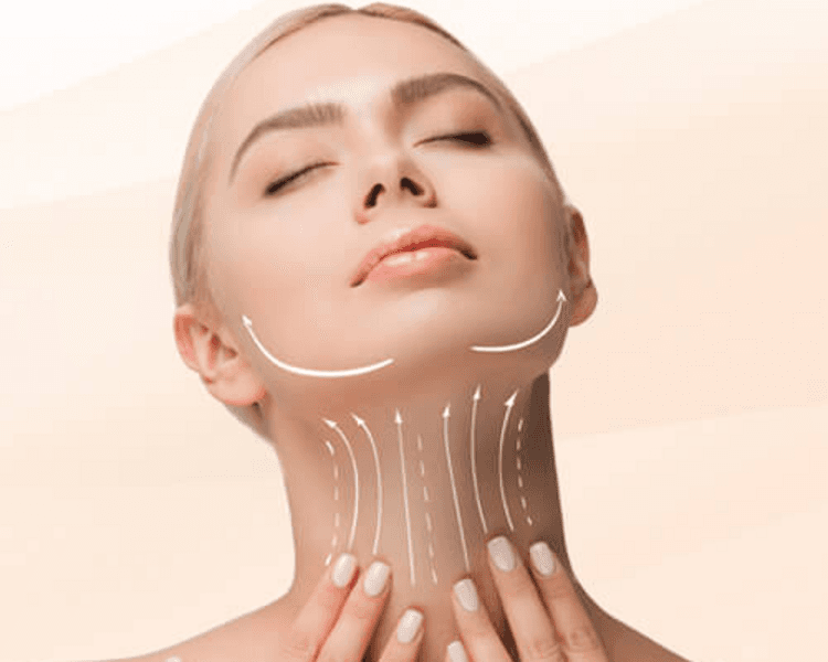 Hilos Tensores – Lifting Facial