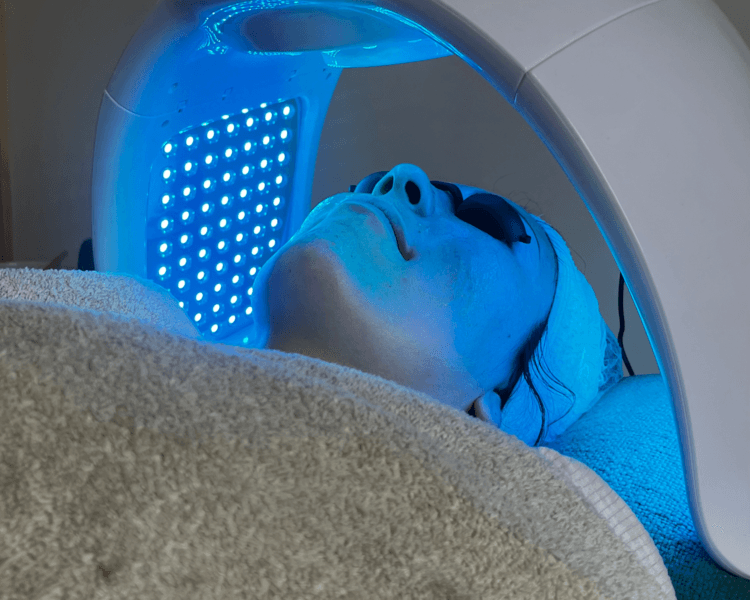 Limpieza Facial Profunda