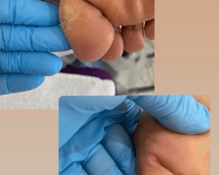 Pedicure Spa Podalica