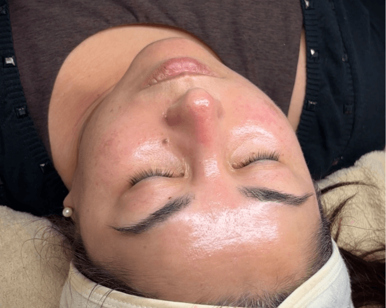 Activación mitocondrial