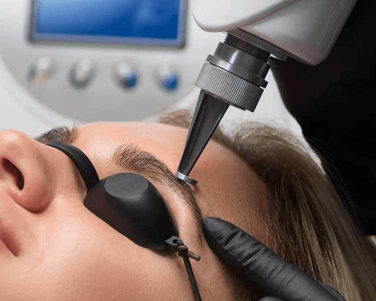 Eliminación de Microblanding