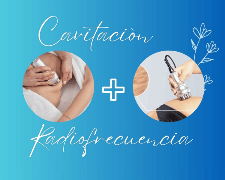 Cavitacion + radiofrecuencia💥