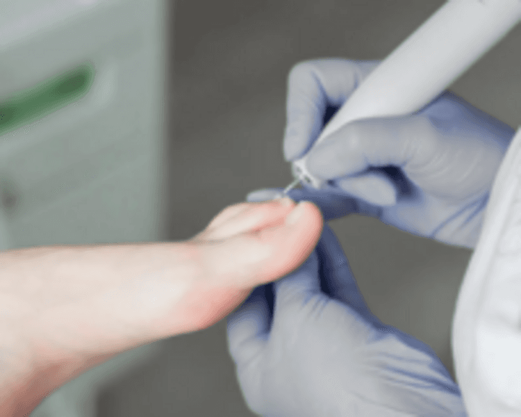 Atención Podológica Integral