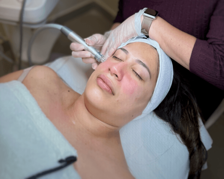Limpieza con Hydrafacial