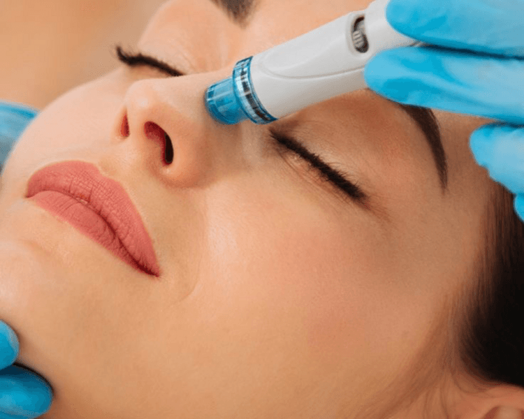 Limpieza Hydrafacial