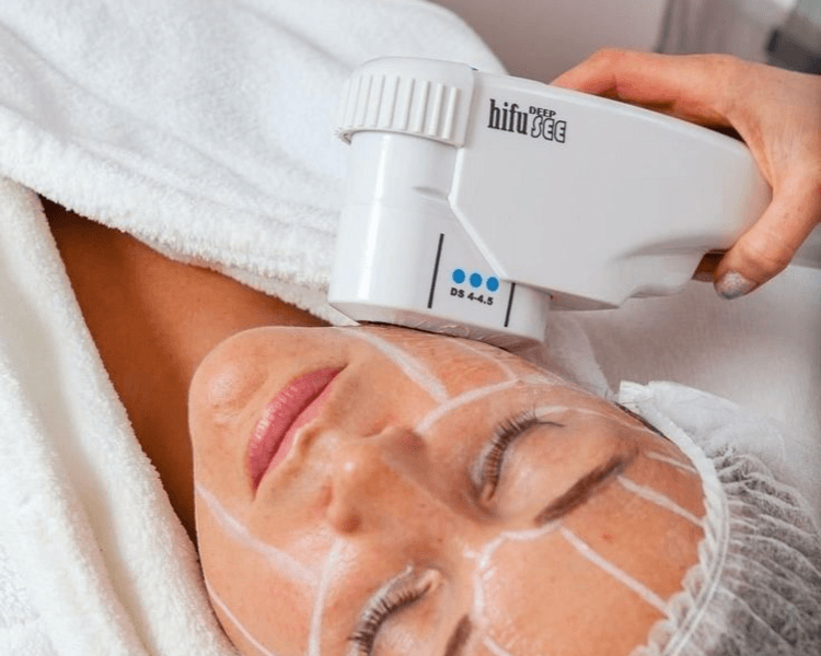 Hifu rostro