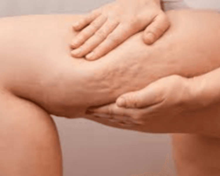 Para combatir Celulitis