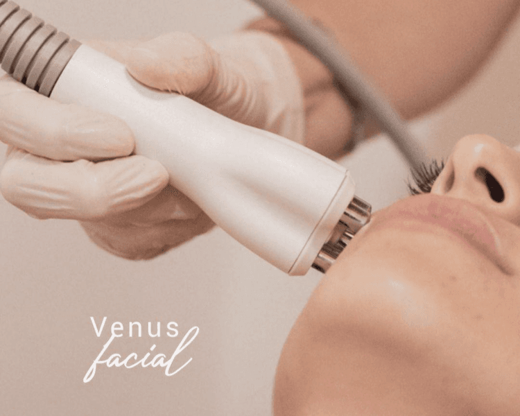 VENUS LEGACY FACIAL O CORPORAL