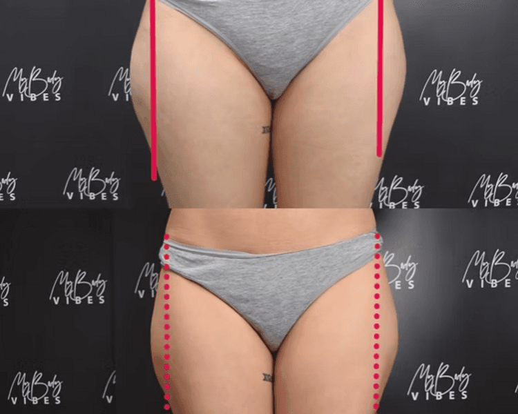 HIFU 25D: Pantalón de montar