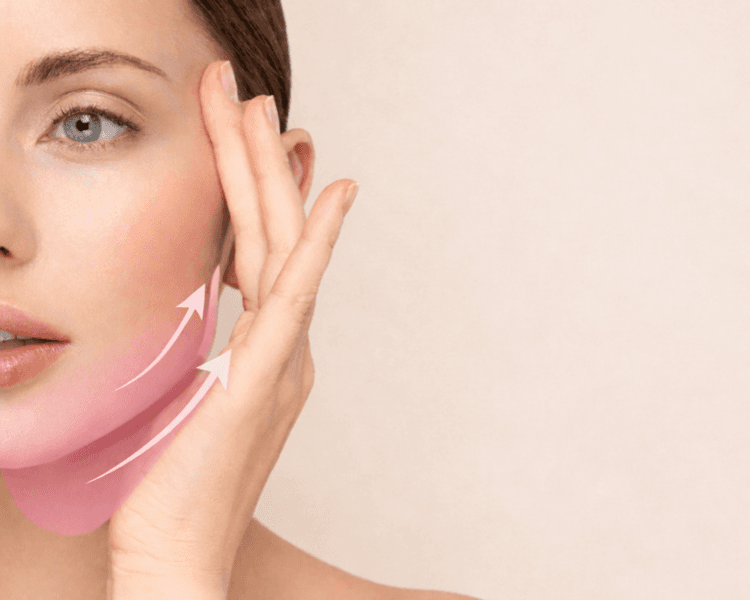 Ultrahifu contorno mandibular y papada