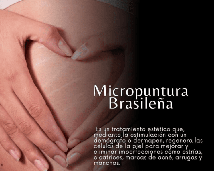 Micropuntura Brasileña
