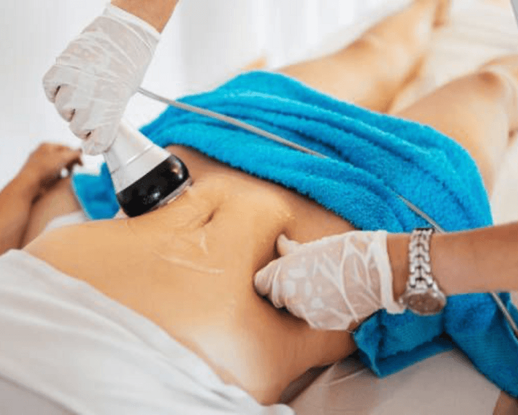 ✨ Radiofrecuencia Corporal BA 🌿⚡