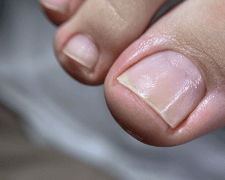 BELLEZA DE PIES (seña obligatoria de $7.000)