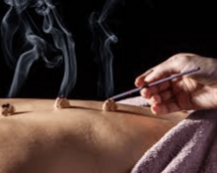 Acupuntura 4 Sesiones