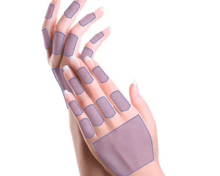 Manos - 6 Sesiones - Depilación Zona S