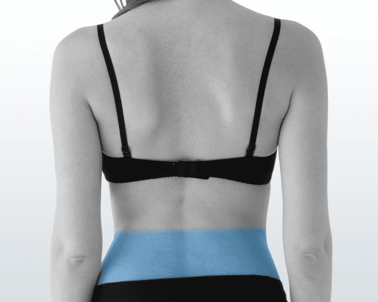 Coxis - 6 Sesiones - Depilación Zona M