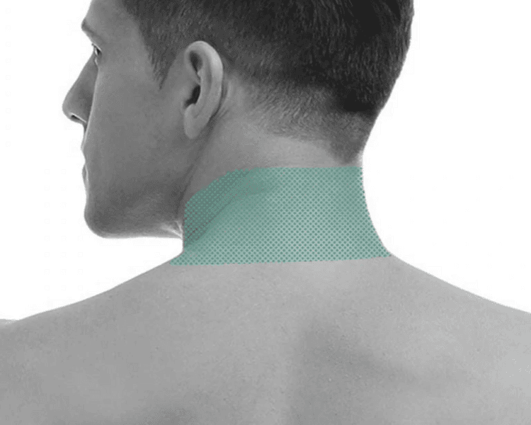 Nuca - 6 Sesiones - Depilación Zona M