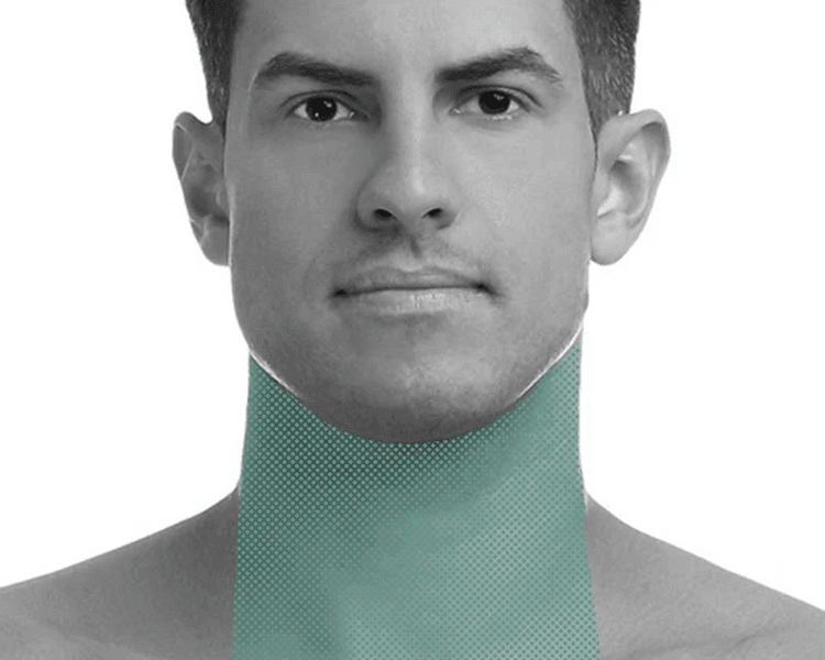 Cuello - 6 Sesiones - Depilación Zona M