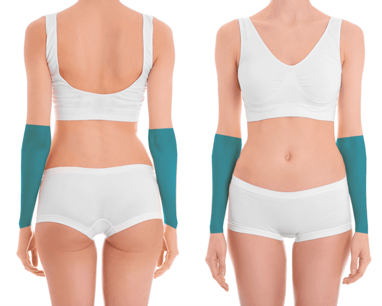 Medio Brazos - 6 Sesiones - Depilación Zona M