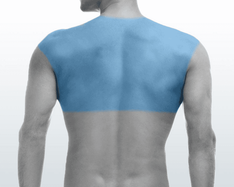 Media Espalda - 6 Sesiones - Depilación Zona M