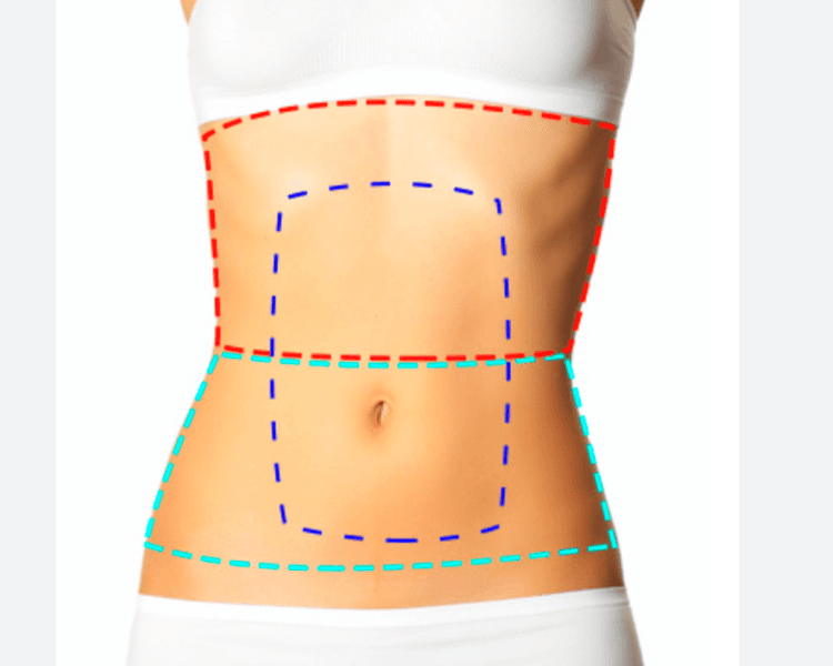 Medio Abdomen - 6 Sesiones - Depilación Zona M