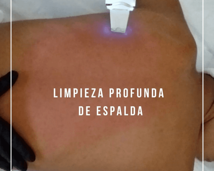 Limpieza Profunda Espalda