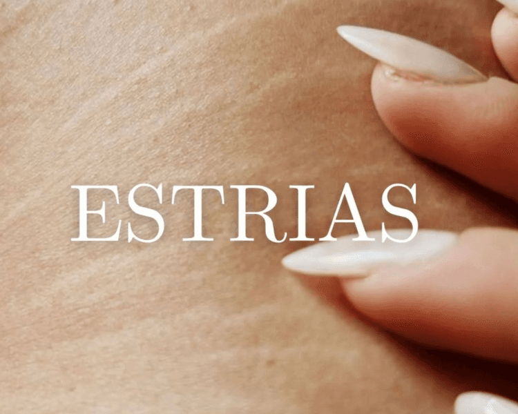 Tratamiento Estrias