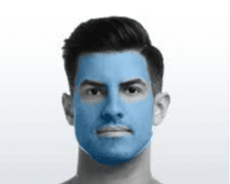 Cara Completa - 6 Sesiones - Depilación Zona L